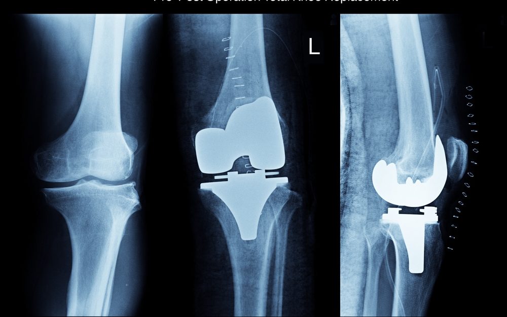 shutterstock_509452792