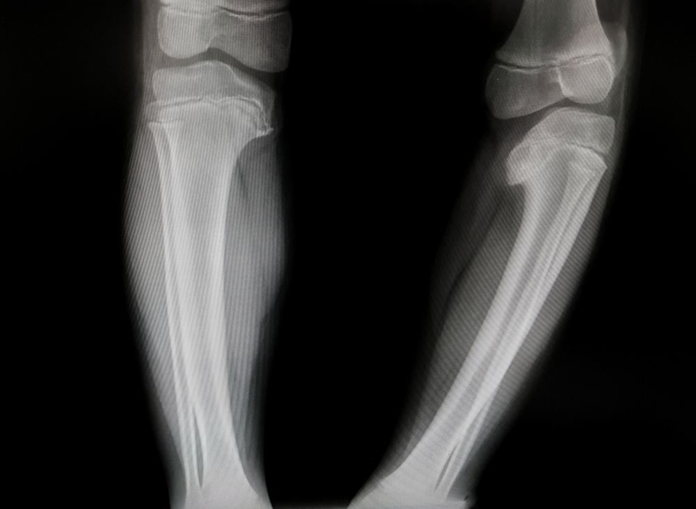 shutterstock_1452967904